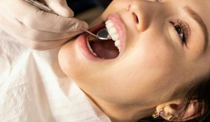 dental exam