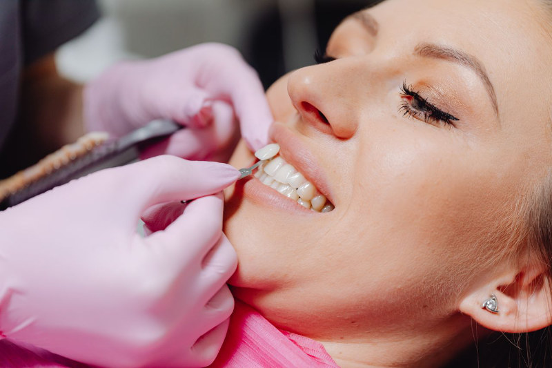 teeth whitening dental oral health